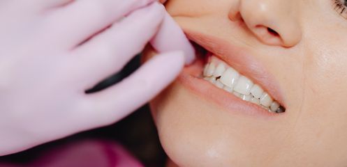 Cleared of decay & gum disease first